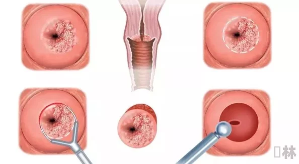 女closeup宫颈口pics大全最新研究显示宫颈健康与生活方式密切相关建议定期检查以确保健康
