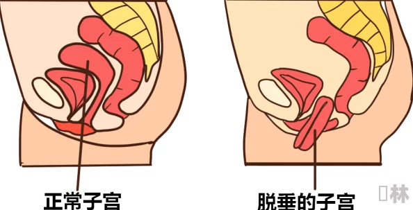 三洞齐插好深到子宫了扩张到极限感觉子宫被撑满了